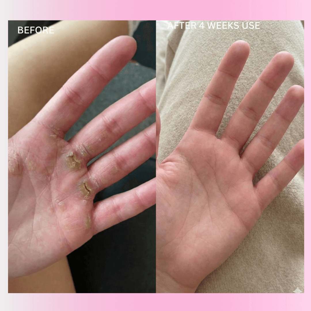 GripHer™ PalmShield